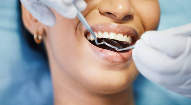 Best Emergency Tooth Extraction  in Buffalo, MN